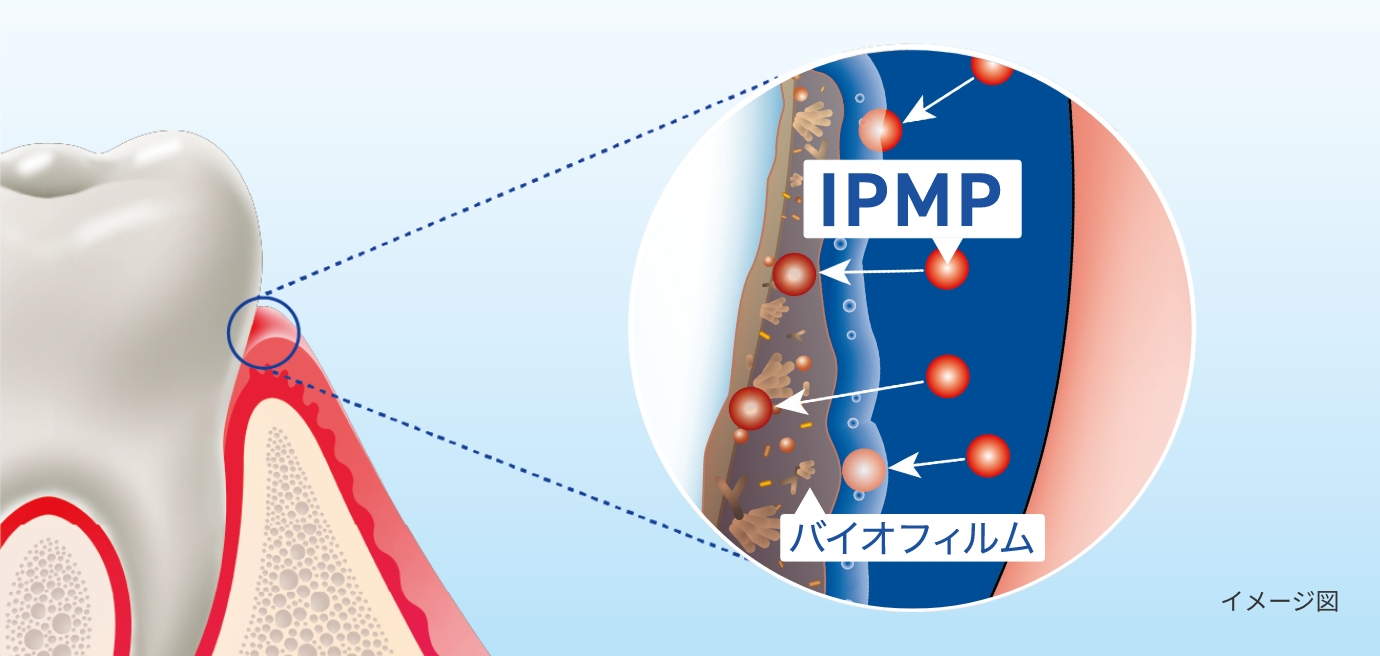 spt_gel_plus_common3